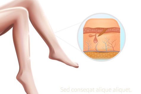 Infographics Woman Smooth Silk Legs Cross Section